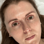 lash-lift-results