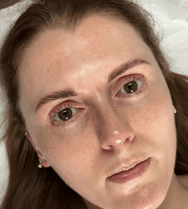 lash-lift-results